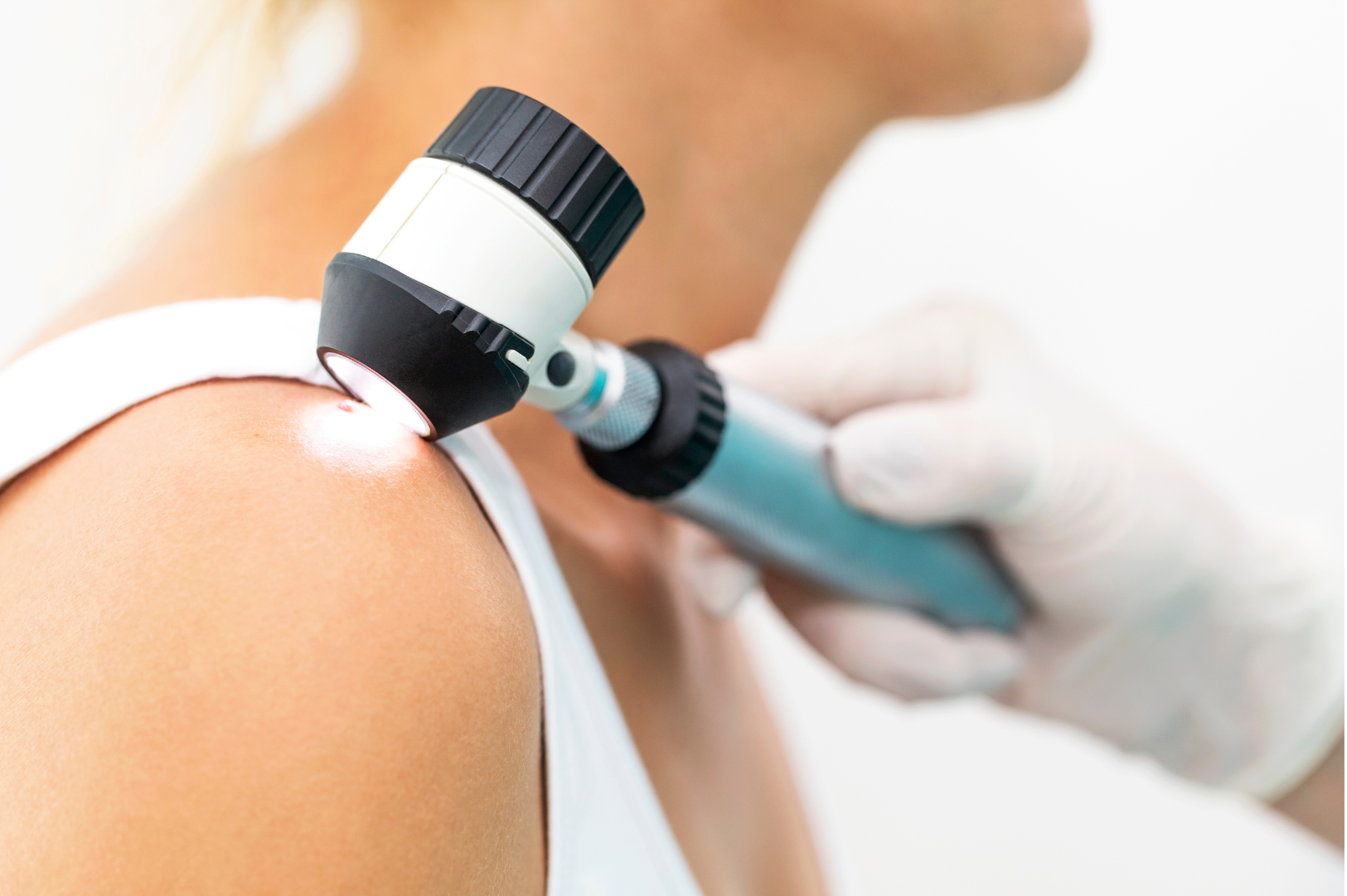 Skin cancers